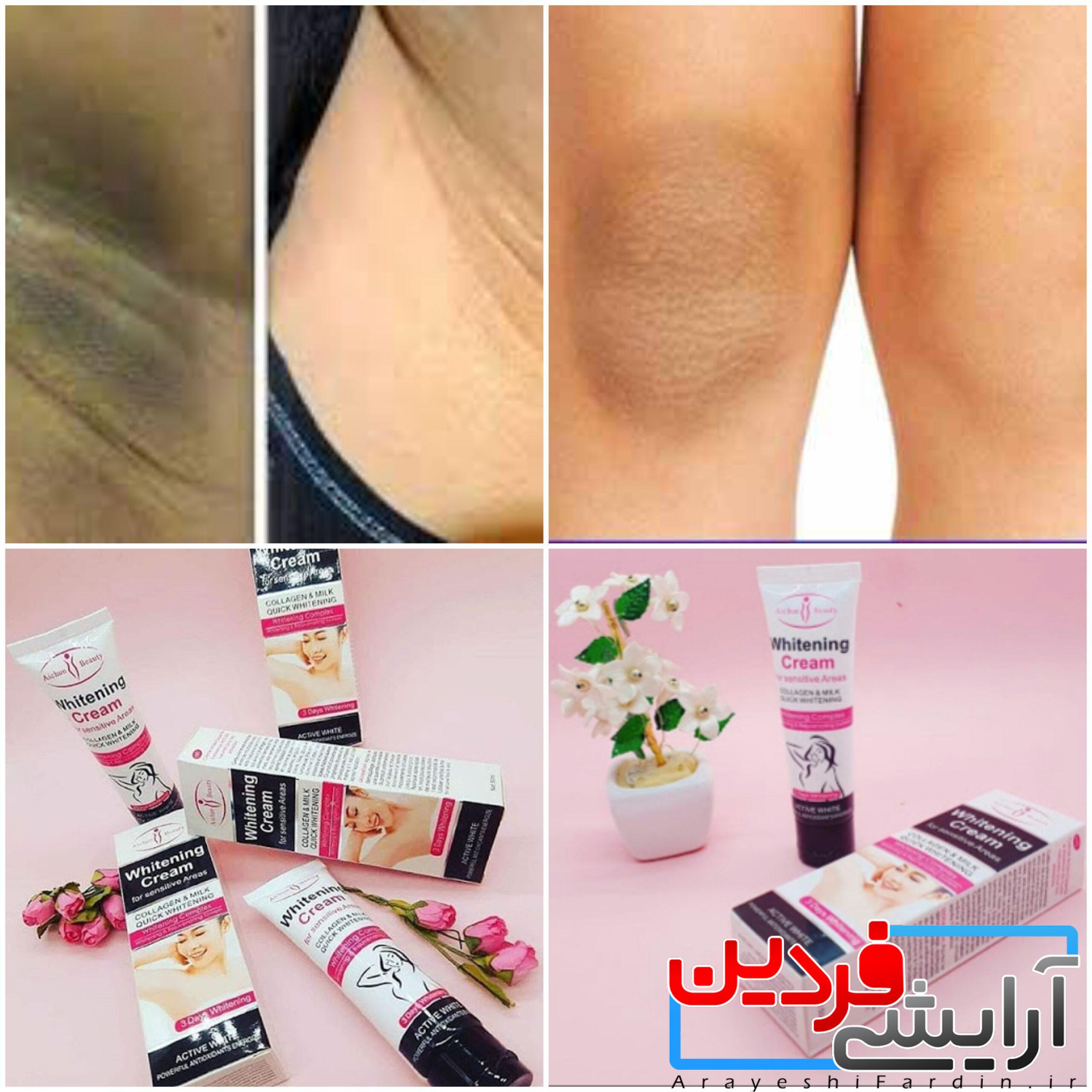 1a7e5bb6811b8c848063869efab7aaf8 Aichun Beauty Cream بدن کرم سفید کننده پوست لوسیون بدن زیر بغل کرم روشن کننده پوست تیره زیر بغل سفید کننده صمیمی - Image 8
