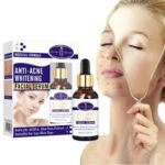 سرم صورت سفید کننده و ضد آکنه Aichun Beauty Onkessy Face Serum Fade Scar Essence - Image 3
