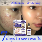 سرم صورت سفید کننده و ضد آکنه Aichun Beauty Onkessy Face Serum Fade Scar Essence - Image 5