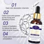 سرم صورت سفید کننده و ضد آکنه Aichun Beauty Onkessy Face Serum Fade Scar Essence - Image 6
