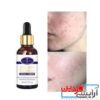 سرم صورت سفید کننده و ضد آکنه Aichun Beauty Onkessy Face Serum Fade Scar Essence - Image 7