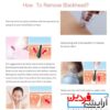 میکرودرم پاک کننده جوش های پوستی و مراقبت از پاک کننده پوست صورت 5 کاره - Image 7