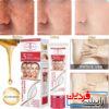 کرم سفید کننده در3روز آیچون بیوتی - Image 3