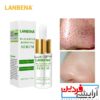 سرم رفع جوش سر سیاه و بستن منافذ بینی لانبنا LANBENA - Image 4