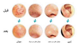 ست کومدون(پیلینگ صورت) 6 تکه کیف چرمی - Image 3