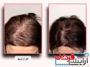 کوکتل مو رویتاکر هیرکر (Haircare) - Image 4