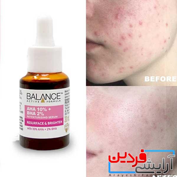 IMG_9650 سرم لایه بردار بالانس بازسازی کننده پوست - Image 2