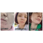 سرم روشن‌کننده (Beauty of Joseon Light On Serum Centella + Vita C) - Image 3