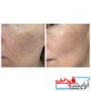 آمپول التیام بخش سنتلا اسکین 100میل SKIN1004 Madagascar Centella - Image 3