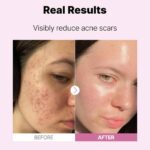 سرم نیاسینامید 15 درصد کوزارکس (COSRX The Niacinamide 15 Serum) - Image 2
