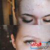 تونر ضد جوش و آبرسان SOME BY MI AHA.BHA.PHA 30 DAYS TONER - Image 3