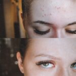 تونر ضد جوش و آبرسان SOME BY MI AHA.BHA.PHA 30 DAYS TONER - Image 3