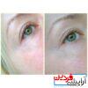 تونر ضد جوش و آبرسان SOME BY MI AHA.BHA.PHA 30 DAYS TONER - Image 4