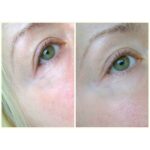 تونر ضد جوش و آبرسان SOME BY MI AHA.BHA.PHA 30 DAYS TONER - Image 4