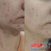 تونر روشن‌کننده سام بای می (Some By Mi Yuja Niacin 30 Days) - Image 3