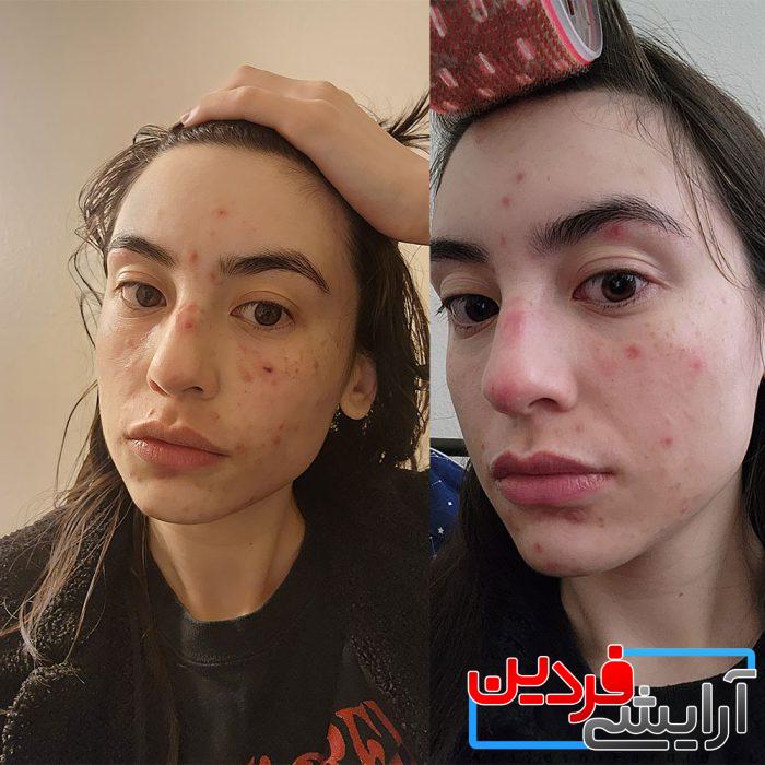 سرم-روغنی-رتینول-0.5-درصد-کوزارکس-ضد-چین-و-چروک-و-آکنه-COSRX-The-Retinol-0.5-Oil-20ml-11-700x700-1 (1) سرم روغنی رتینول 0.5 درصد کوزارکس (COSRX Retinol 0.5 Oil) - Image 2