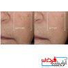 سرم ضد چروک و جوانساز لانکوم مدل رینرژی H.C.F LANCOME - Image 4