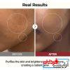 تونر درملاکسین پیل شات گلوس وایت رایس Dr.Melaxin Peel Shot Glow - Image 6