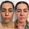 اسپری لایه بردار و روشن کننده پوست دکتر ملاکسین Dr.Melaxin - Image 5
